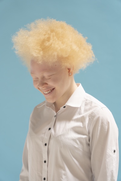 portret studyjny usmiechnietej albinoski w bialej