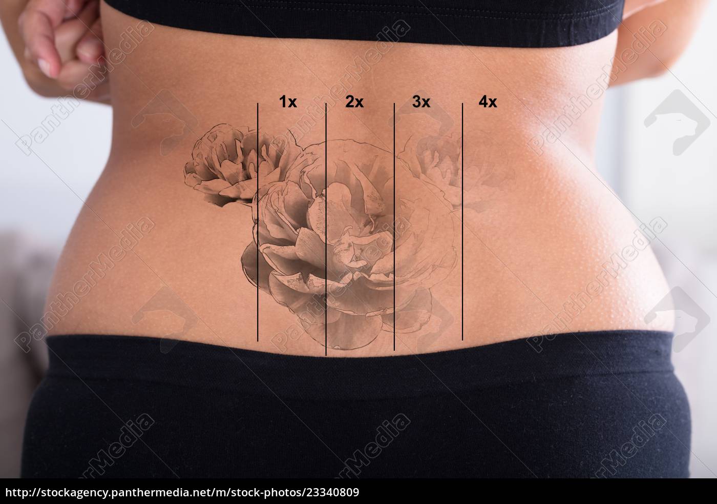 Eliminación de tatuajes en la cadera de la mujer - Foto de archivo  #23340809 | Agencia de stock PantherMedia