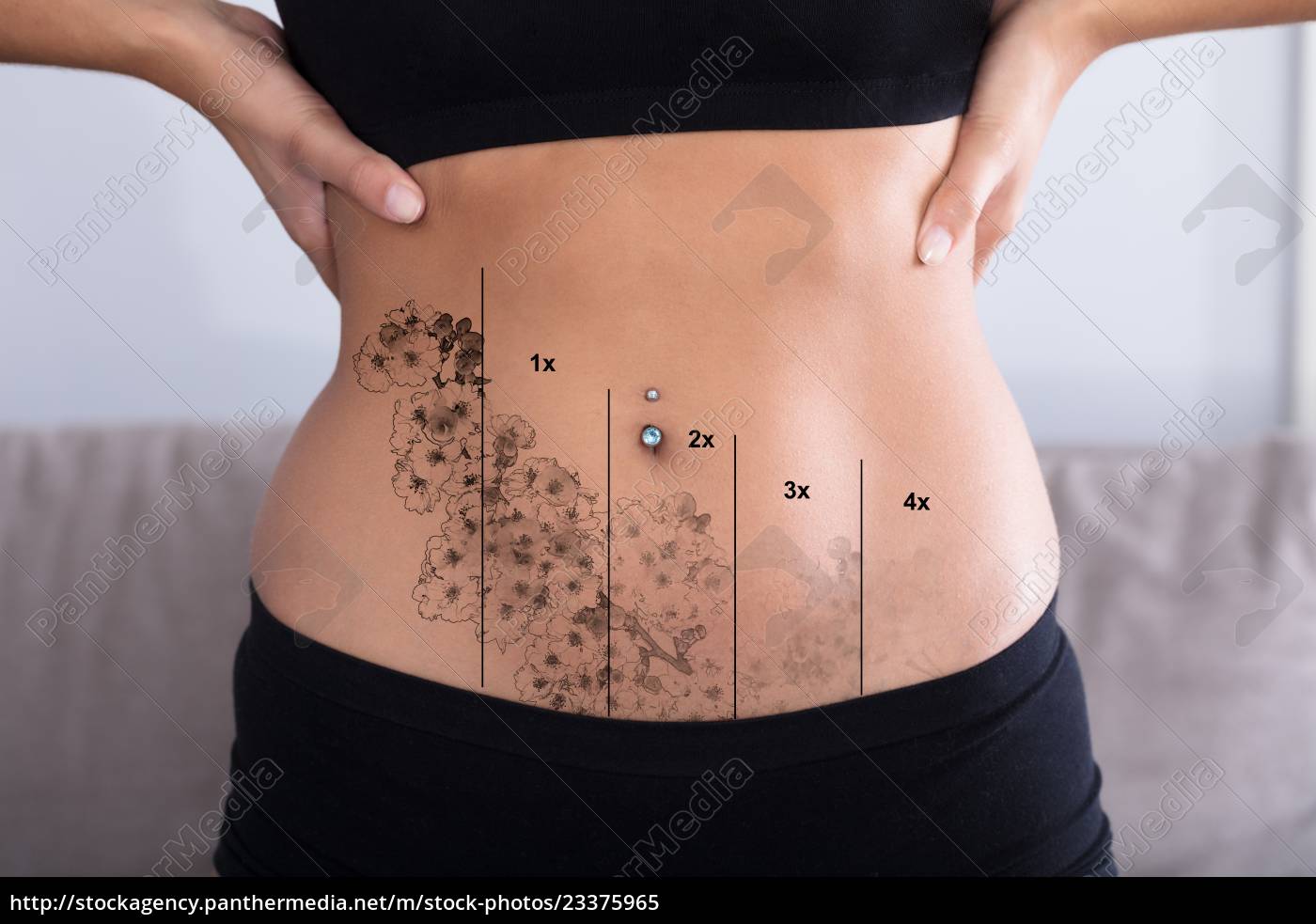 Laser Tattoo Removal On Woman s Stomach - Stock Photo #23375965 |  PantherMedia Stock Agency